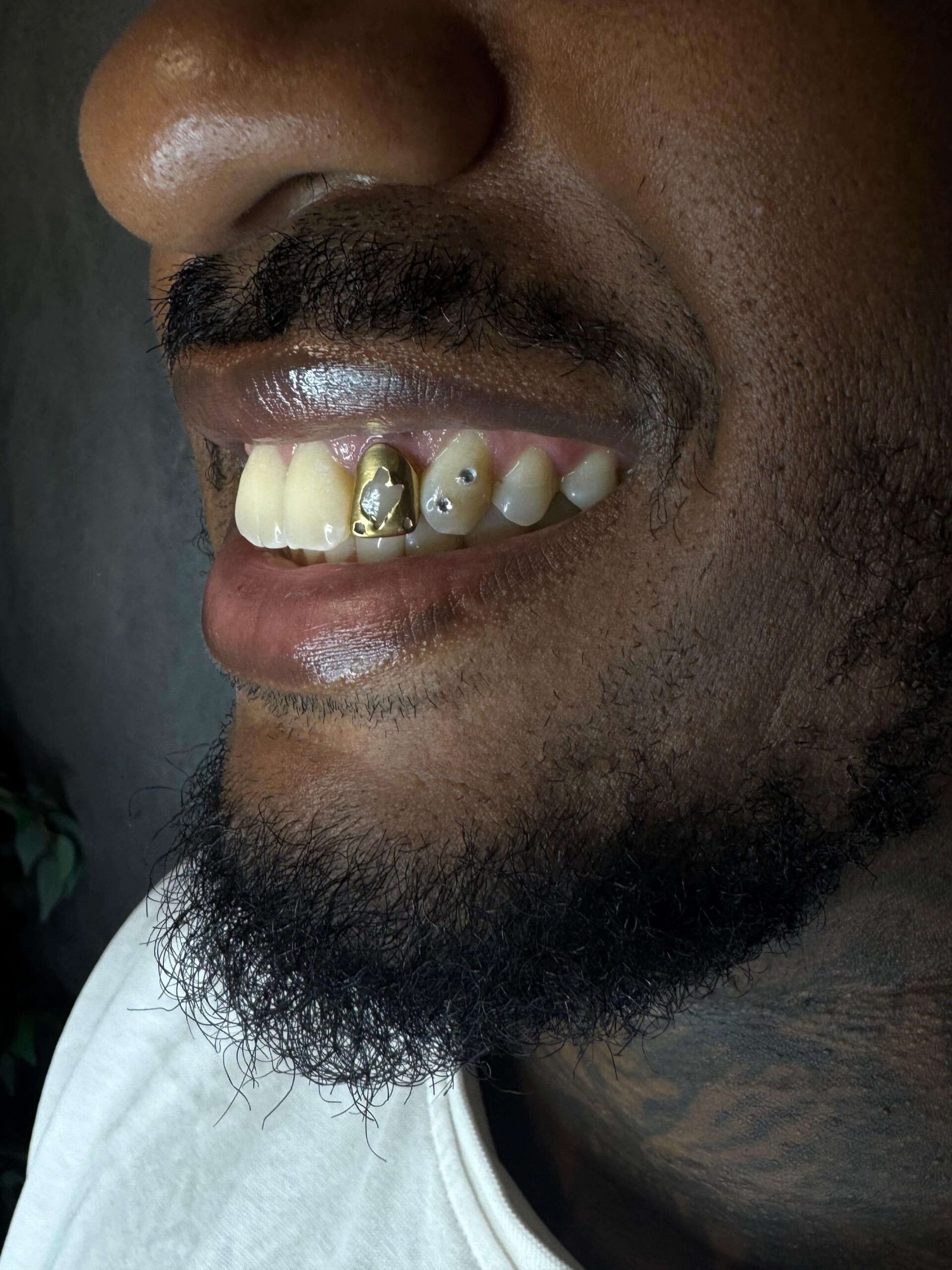 Toothgem inspiratie Ninety-Nine Beauties 02
