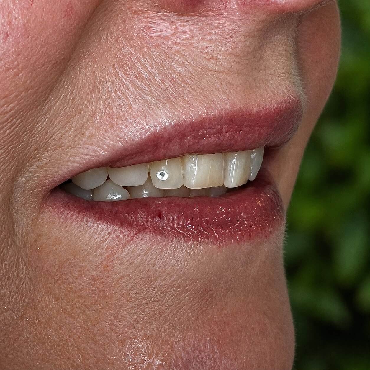 Toothgem inspiratie Ninety-Nine Beauties 05
