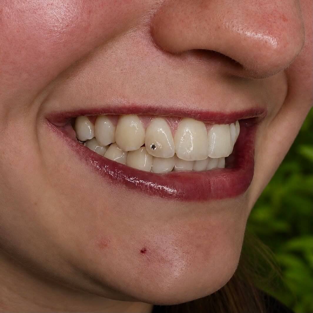 Toothgem inspiratie Ninety-Nine Beauties 06