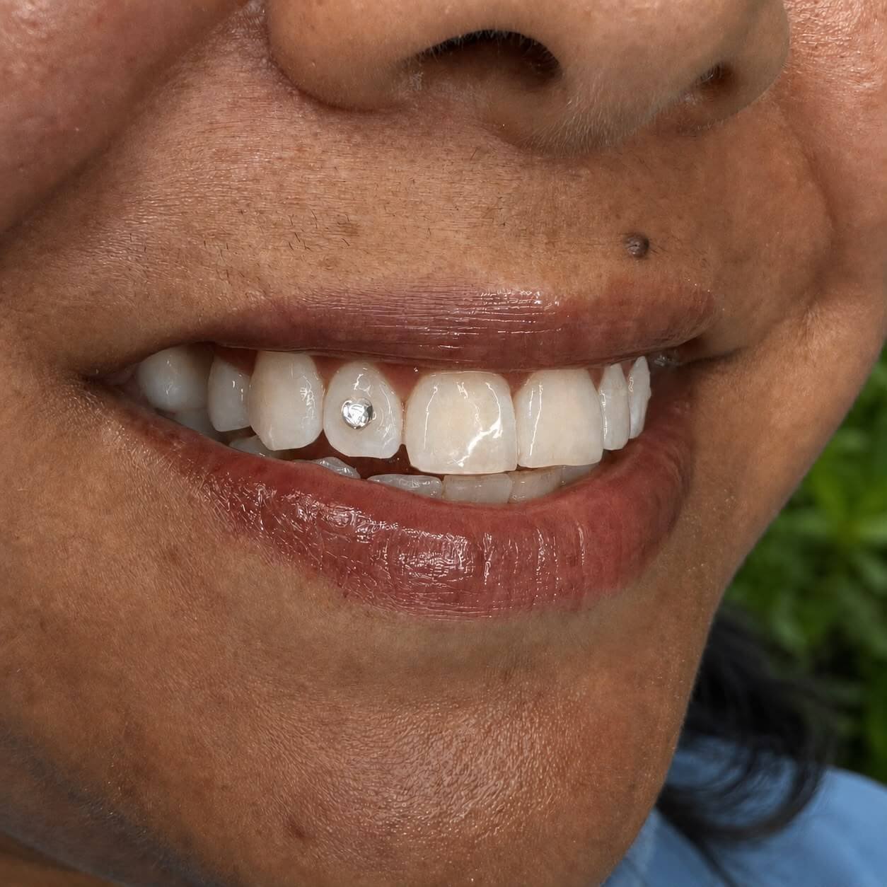 Toothgem inspiratie Ninety-Nine Beauties 04
