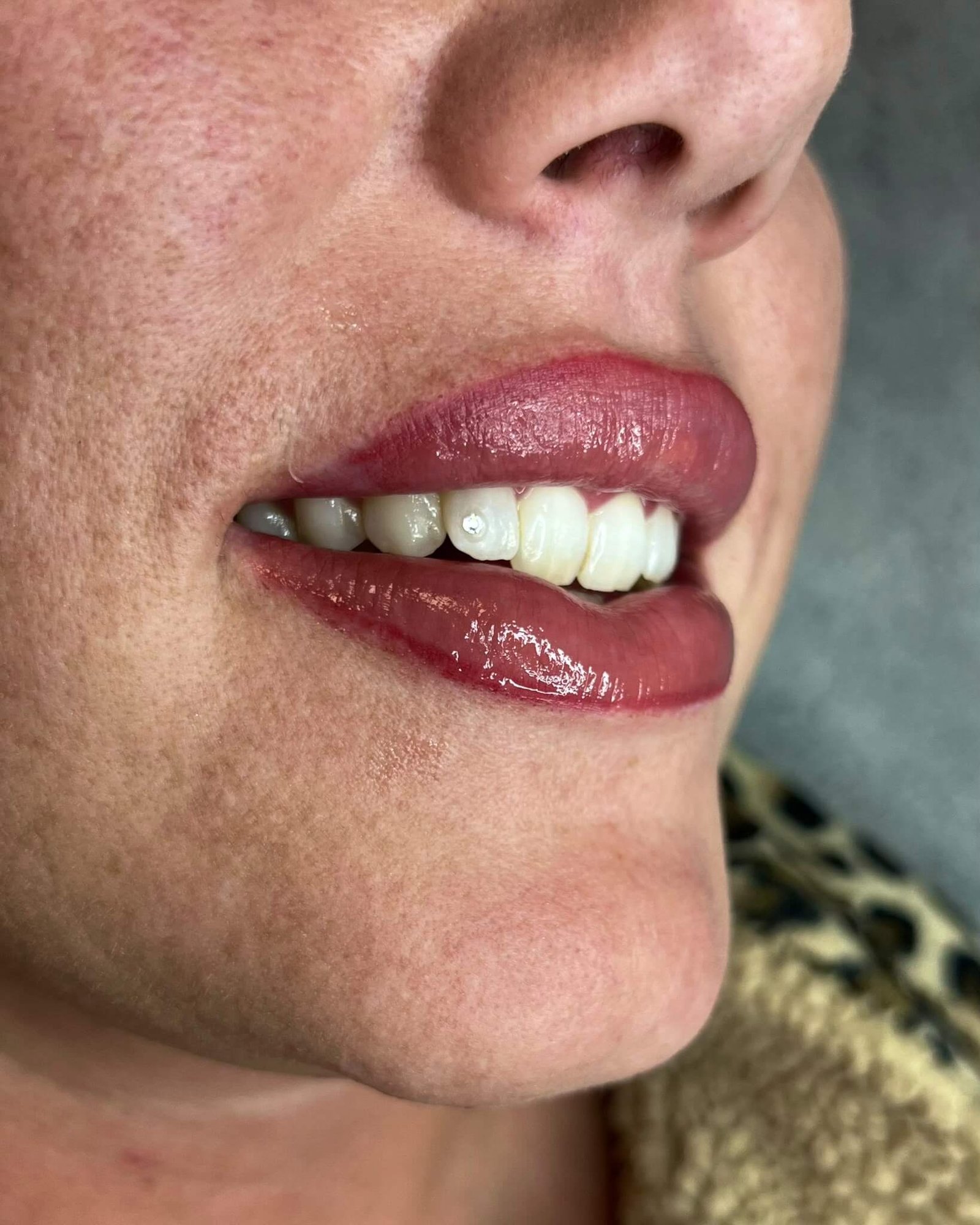 Toothgem inspiratie Ninety-Nine Beauties 01