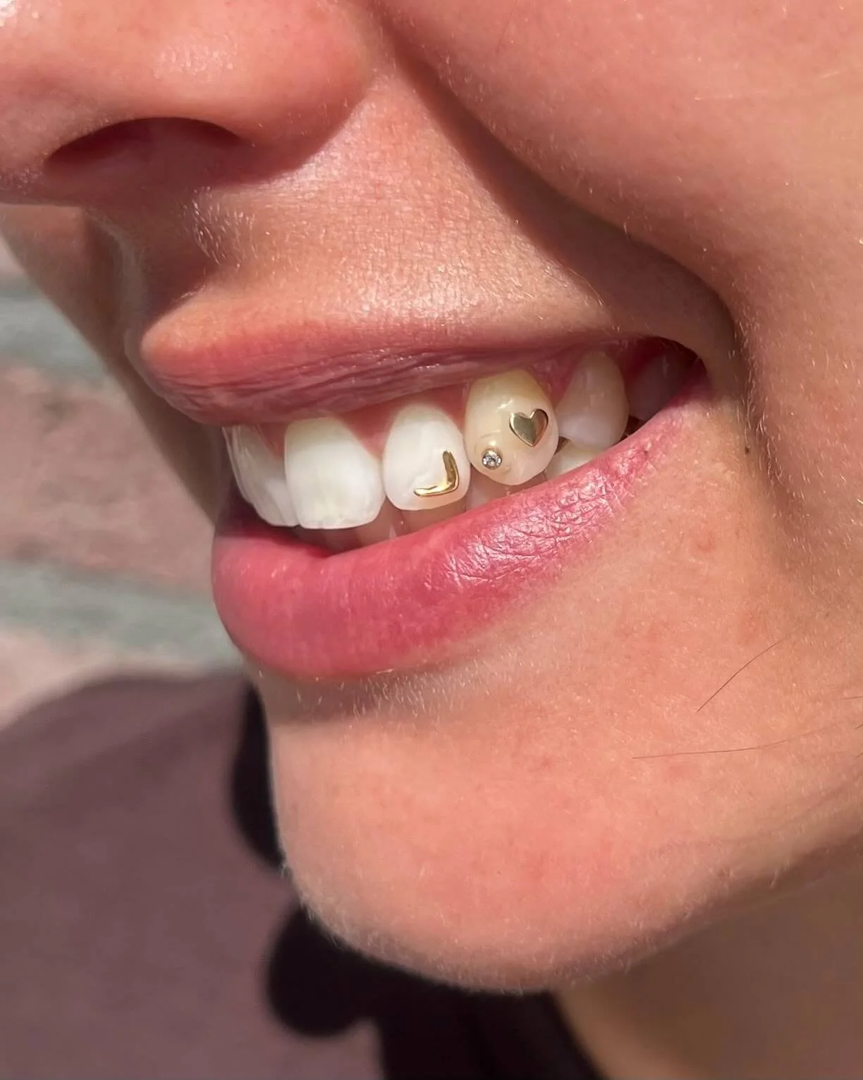 Creatieve mix en match toothgems laten zetten