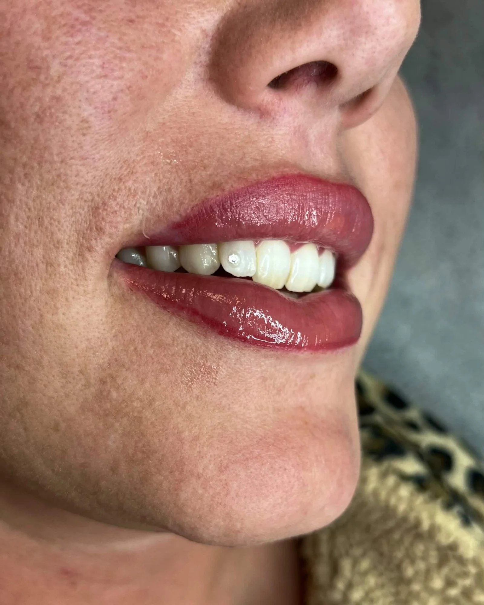 Subtiele kristal toothgem laten zetten op hoektand